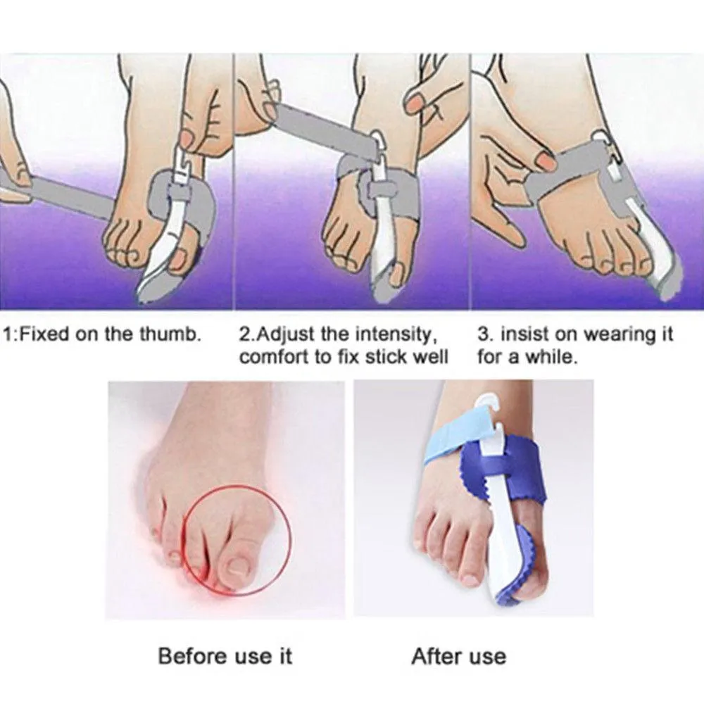 Glamza Splint Corrector Device Pair